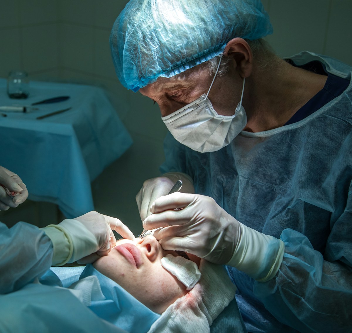 Blade free LASIK